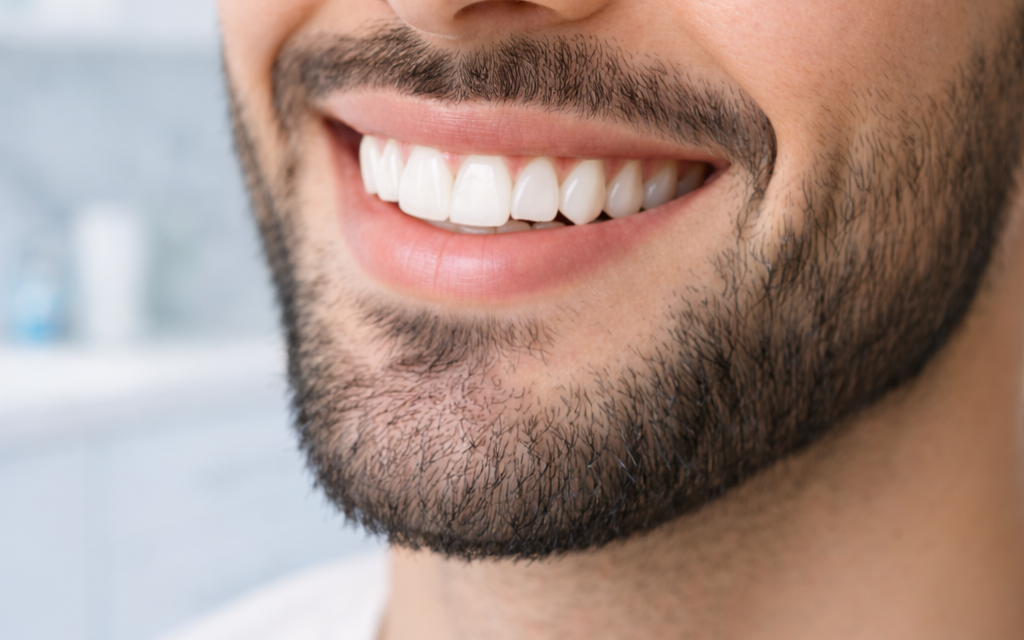 Sourire naturel vs sourire artificiel