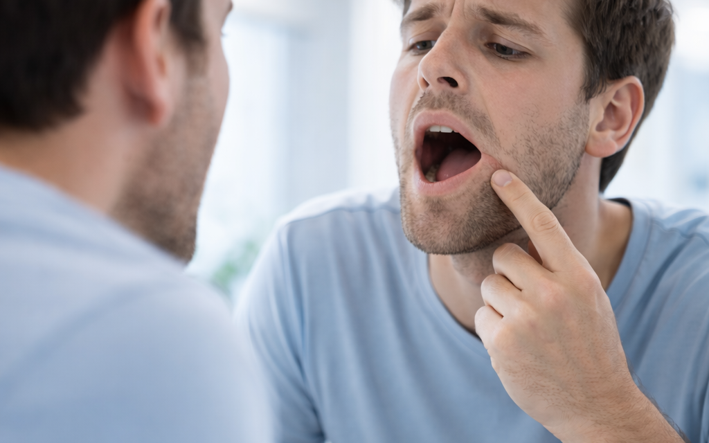Traitement des aphtes : soulager rapidement les douleurs buccales